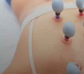 Санаторий «Шахтер», фото 9