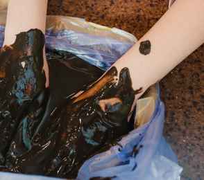 Санаторий «Чувашиякурорт», фото 54